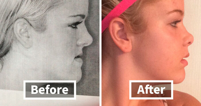 90 Mildly Interesting Before-And-After Photos That Show Just How Much Things Can Change