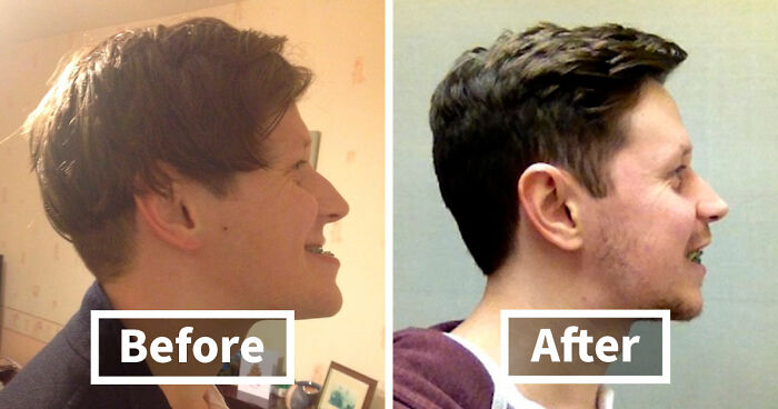 90 Mildly Interesting Before-And-After Photos That Show Just How Much Things Can Change