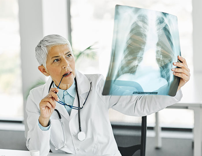 Female doctor examining an X-ray of lungs, reflecting on a teen's refusal to donate a lung to his mom. Female doctor examining an X-ray of lungs, reflecting on a teen's refusal to donate a lung to his mom.