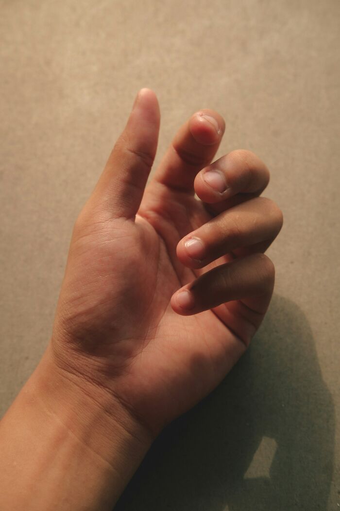 26 Stories About What Doctors Do When They Are Convinced A Patient Is Faking It