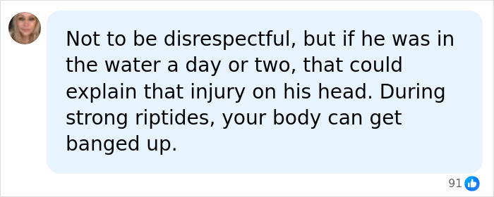 Social media comment explaining a head injury with strong current during preliminary autopsy results.