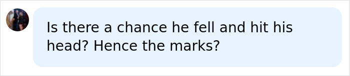 A social media comment asking if a fall could explain marks in the Nolan Wells case and preliminary autopsy results.