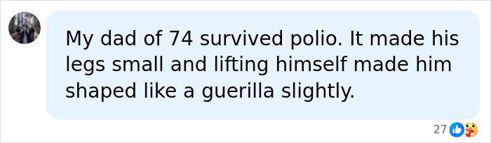 A social media comment from a user sharing their dad survived polio, affecting his legs.