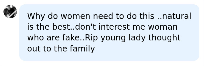 A social media comment discussing the mother who passes away after botched Turkish surgery and celebrating natural beauty. A social media comment discussing the mother who passes away after botched Turkish surgery and celebrating natural beauty.