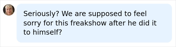 A comment questioning why people should feel sorry for the Black Alien after his self-inflicted changes. A comment questioning why people should feel sorry for the Black Alien after his self-inflicted changes.