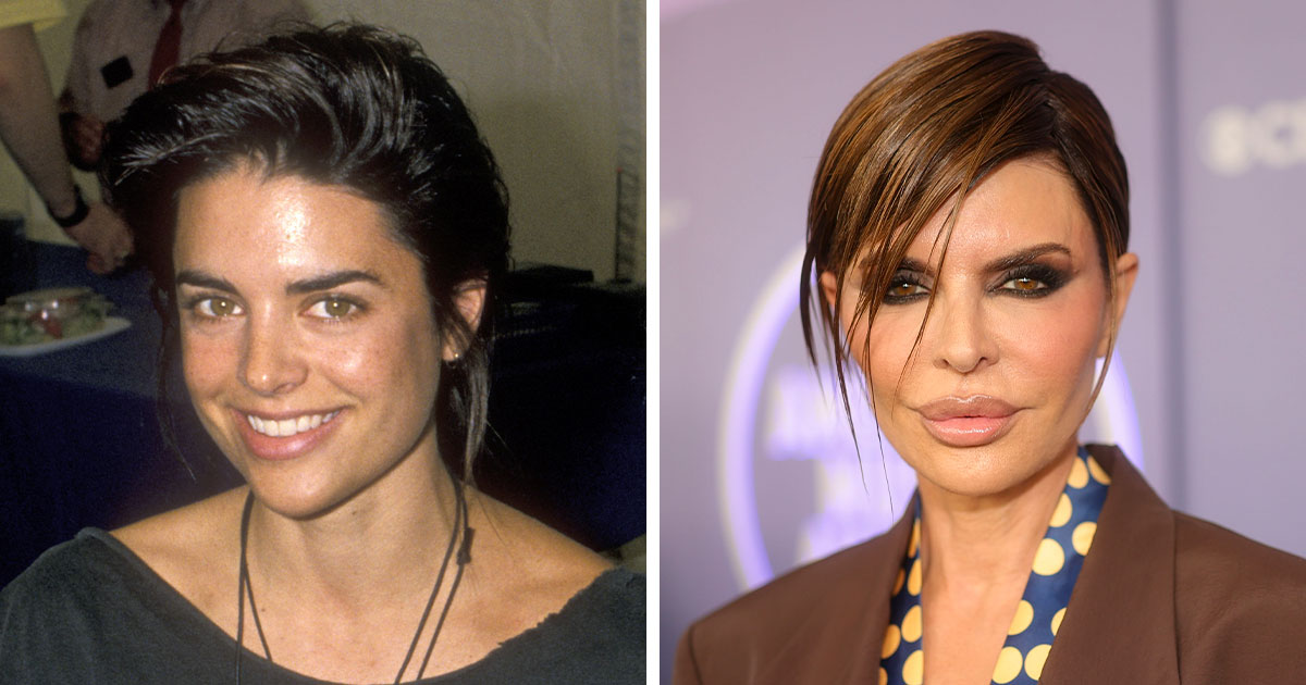 Earlier Looks: Celebrity Faces Before And After Plastic Surgery