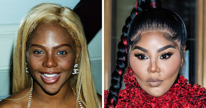 15 Before-And-After Photos Of Celebrities Who Couldn’t Stop Getting Plastic Surgeries