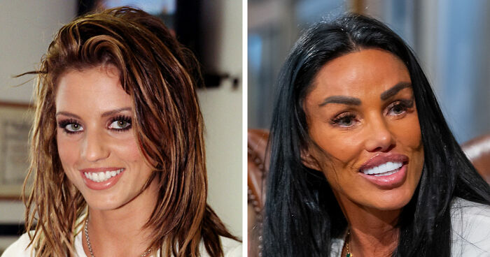 15 Pre-Plastic Surgery Photos Of Celebrities That Are Hard To Process