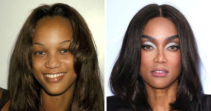 15 Pre-Plastic Surgery Photos Of Celebrities That Are Hard To Process