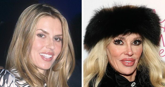 15 Pre-Plastic Surgery Photos Of Celebrities That Are Hard To Process