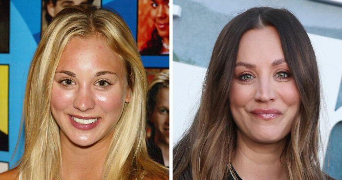 15 Pre-Plastic Surgery Photos Of Celebrities That Are Hard To Process