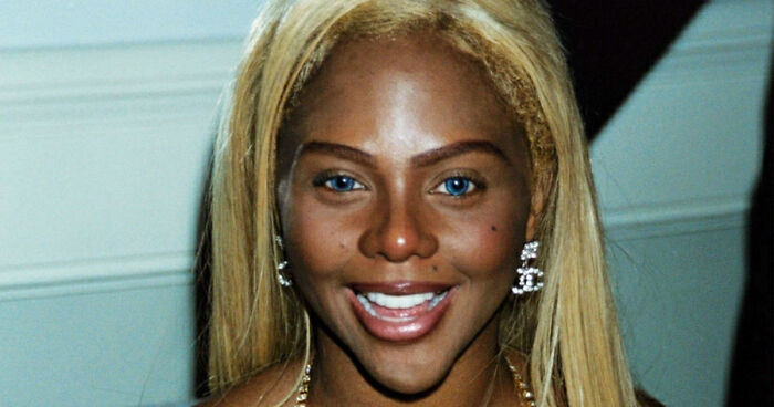 15 Pre-Plastic Surgery Photos Of Celebrities That Are Hard To Process