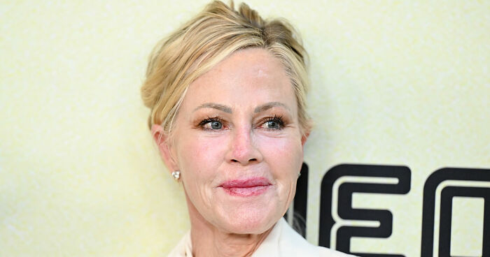 15 Pre-Plastic Surgery Photos Of Celebrities That Are Hard To Process