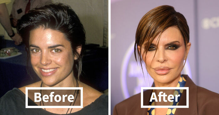 15 Pre-Plastic Surgery Photos Of Celebrities That Are Hard To Process