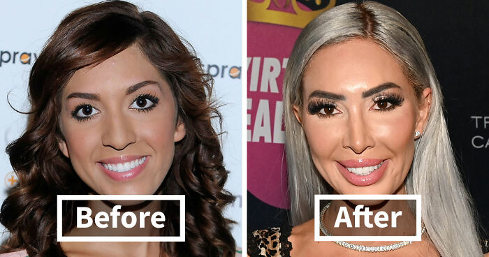 15 Pre-Plastic Surgery Photos Of Celebrities That Are Hard To Process