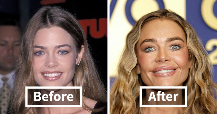15 Pre-Plastic Surgery Photos Of Celebrities That Are Hard To Process