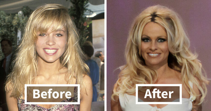 15 Pre-Plastic Surgery Photos Of Celebrities That Are Hard To Process