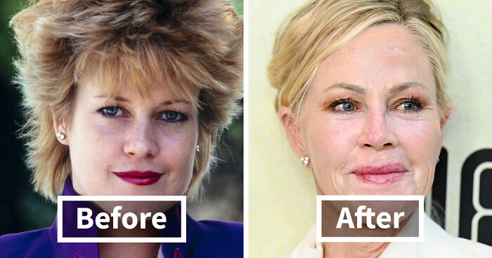 15 Pre-Plastic Surgery Photos Of Celebrities That Are Hard To Process