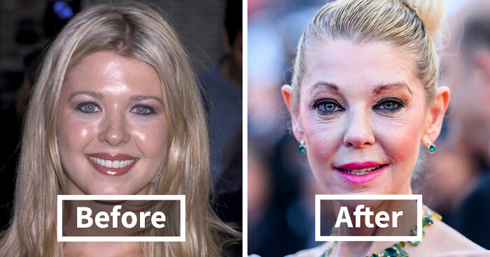 15 Pre-Plastic Surgery Photos Of Celebrities That Are Hard To Process