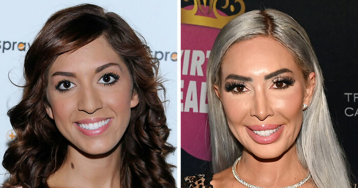 15 Pre-Plastic Surgery Photos Of Celebrities That Are Hard To Process