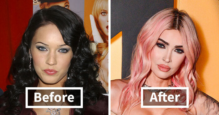 15 Pre-Plastic Surgery Photos Of Celebrities That Are Hard To Process