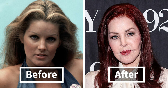 15 Pre-Plastic Surgery Photos Of Celebrities That Are Hard To Process