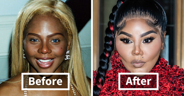 15 Pre-Plastic Surgery Photos Of Celebrities That Are Hard To Process