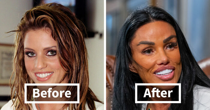 15 Pre-Plastic Surgery Photos Of Celebrities That Are Hard To Process