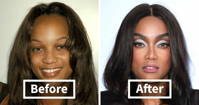 15 Pre-Plastic Surgery Photos Of Celebrities That Are Hard To Process