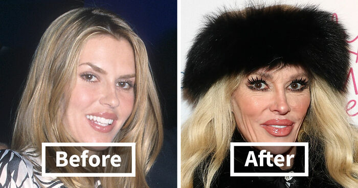 15 Pre-Plastic Surgery Photos Of Celebrities That Are Hard To Process