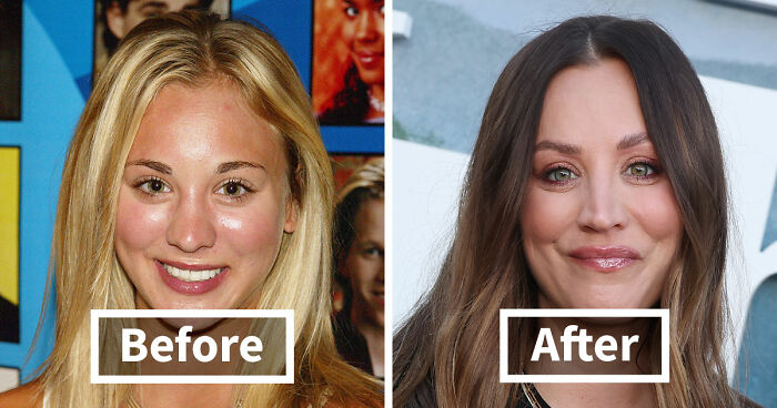 15 Pre-Plastic Surgery Photos Of Celebrities That Are Hard To Process