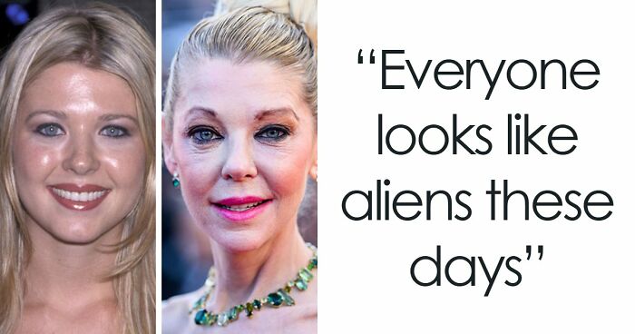 15 Pre-Plastic Surgery Photos Of Celebrities That Are Hard To Process