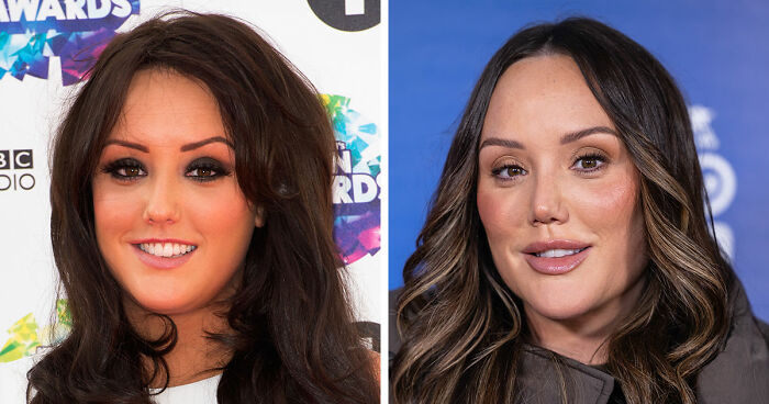 15 Pre-Plastic Surgery Photos Of Celebrities That Are Hard To Process