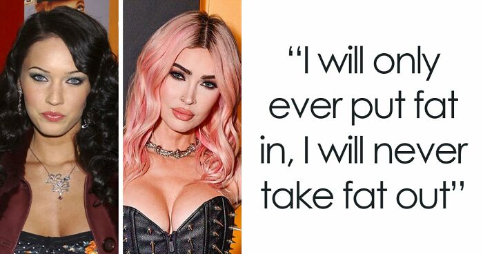 15 Pre-Plastic Surgery Photos Of Celebrities That Are Hard To Process