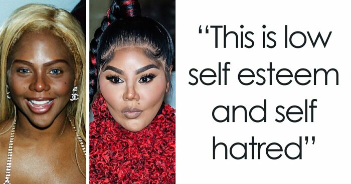 15 Pre-Plastic Surgery Photos Of Celebrities That Are Hard To Process