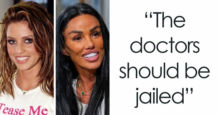 15 Pre-Plastic Surgery Photos Of Celebrities That Are Hard To Process