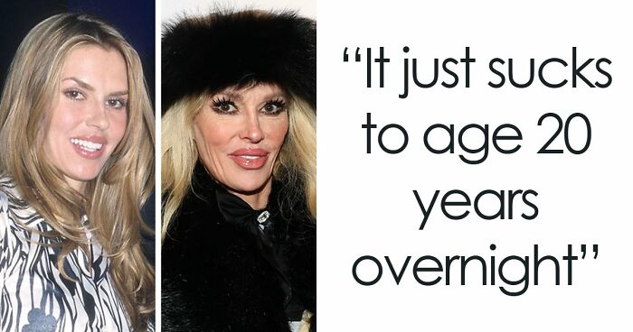 15 Pre-Plastic Surgery Photos Of Celebrities That Are Hard To Process