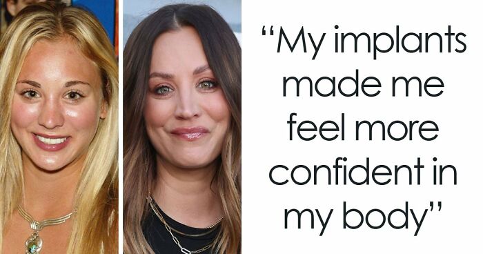 15 Pre-Plastic Surgery Photos Of Celebrities That Are Hard To Process