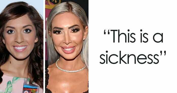 15 Pre-Plastic Surgery Photos Of Celebrities That Are Hard To Process