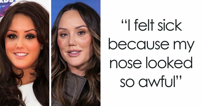 15 Pre-Plastic Surgery Photos Of Celebrities That Are Hard To Process