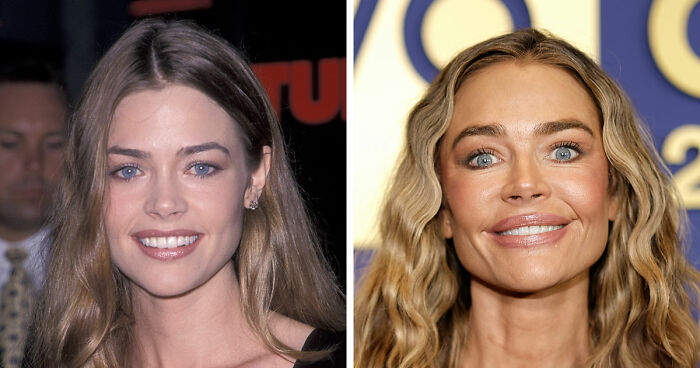 15 Pre-Plastic Surgery Photos Of Celebrities That Are Hard To Process