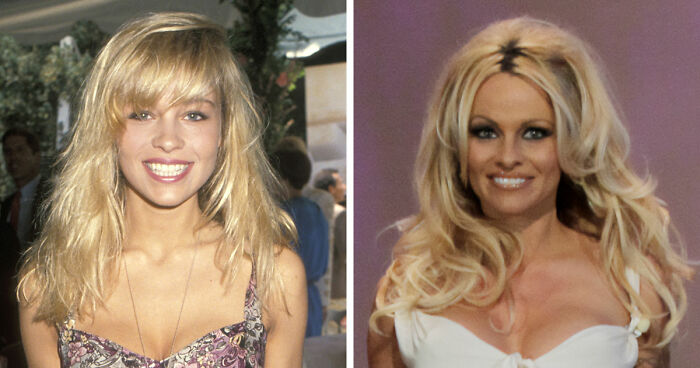 15 Pre-Plastic Surgery Photos Of Celebrities That Are Hard To Process