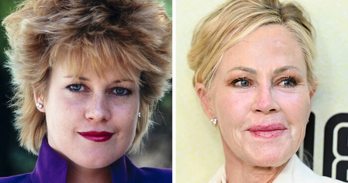 15 Pre-Plastic Surgery Photos Of Celebrities That Are Hard To Process