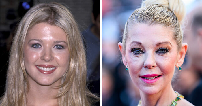 15 Pre-Plastic Surgery Photos Of Celebrities That Are Hard To Process
