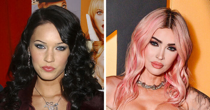 15 Pre-Plastic Surgery Photos Of Celebrities That Are Hard To Process