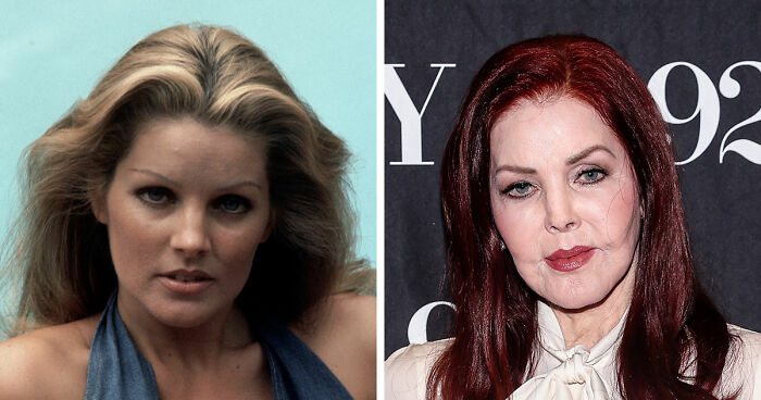 15 Pre-Plastic Surgery Photos Of Celebrities That Are Hard To Process