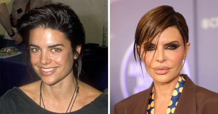 15 Pre-Plastic Surgery Photos Of Celebrities That Are Hard To Process