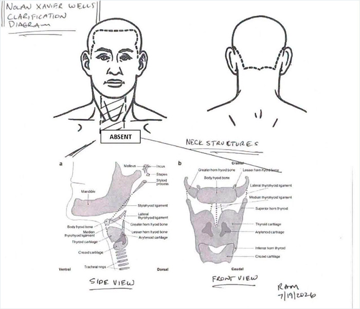 Preliminary autopsy results diagram for Nolan Wells case, detailing neck structures and absence of certain elements.