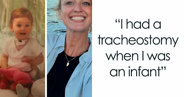 51 People Share The Rarest Things That Have Ever Happened To Them