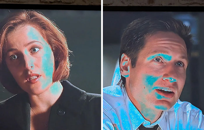 Two faces with blue discoloration, a common problem people ask others for help fixing.
